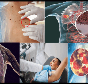 jd 10 habitudes étonnantes qui augmentent vos risques de cancer