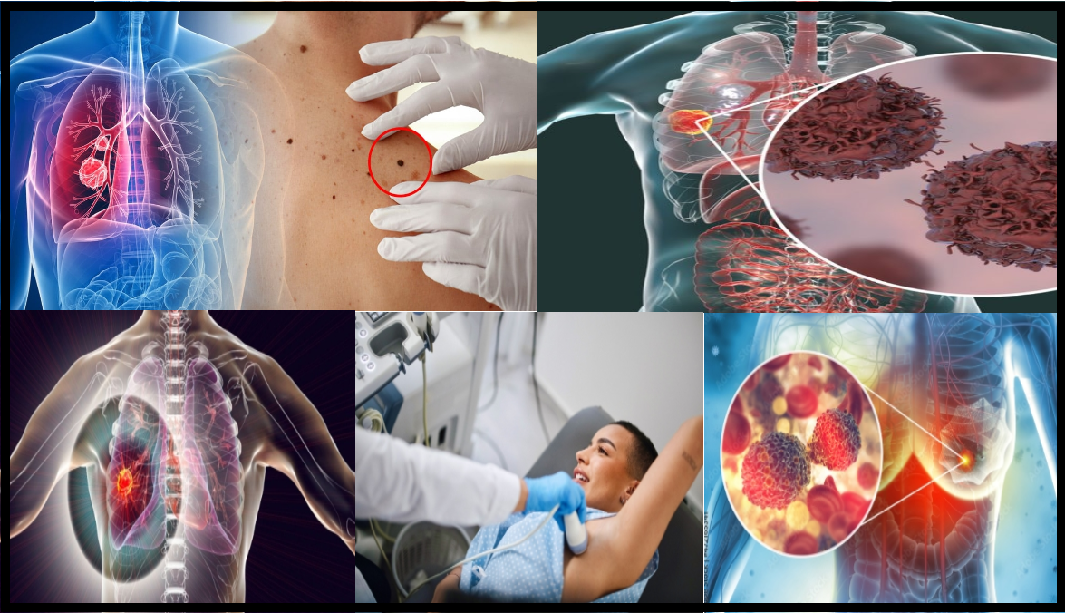 jd 10 habitudes étonnantes qui augmentent vos risques de cancer