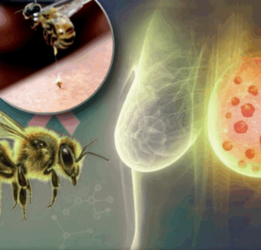 Le venin d’abeille détruit 100 % des cellules cancéreuses du sein les plus agressives en une heure 5 Le venin d’abeille détruit 100 % des cellules cancéreuses du sein les plus agressives en une heure montage final 1762917904 Le venin d’abeille détruit 100 % des cellules cancéreuses du sein les plus agressives en une heure