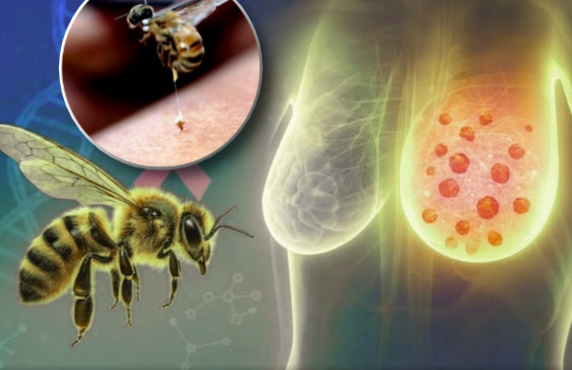 montage final 1762917904 Le venin d’abeille détruit 100 % des cellules cancéreuses du sein les plus agressives en une heure