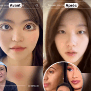 montage final 1763620408 Ce chirurgien TikTok fait exploser le web en dévoilant les supposées chirurgies secrètes des stars