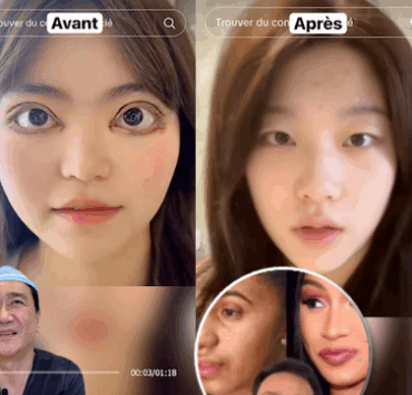 montage final 1763620408 Ce chirurgien TikTok fait exploser le web en dévoilant les supposées chirurgies secrètes des stars