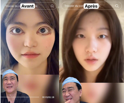 Ce chirurgien TikTok fait exploser le web en dévoilant les supposées chirurgies secrètes des stars 1 Ce chirurgien TikTok fait exploser le web en dévoilant les supposées chirurgies secrètes des stars photo 2025 11 20 01.18.24 e1763620060715 Ce chirurgien TikTok fait exploser le web en dévoilant les supposées chirurgies secrètes des stars