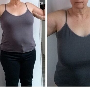 Transformation spectaculaire : les photos parlent d’elles-mêmes 3 Transformation spectaculaire : les photos parlent d’elles-mêmes reduction mammaire tunisie photos avant apres Transformation spectaculaire : les photos parlent d’elles-mêmes