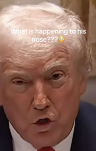 Le Nez de Trump : Un Mystère qui Captive le Monde 2 Le Nez de Trump : Un Mystère qui Captive le Monde Capture decran le 2025 12 04 a 19.04.17 Le Nez de Trump : Un Mystère qui Captive le Monde