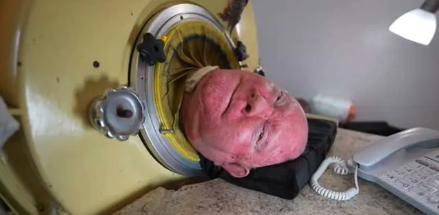 Paul Alexander, 70 ans dans un poumon d’acier : l’incroyable leçon de vie d’un survivant (...) 1 Paul Alexander, 70 ans dans un poumon d’acier : l’incroyable leçon de vie d’un survivant (...) Capture decran le 2025 12 18 a 01.35.27 Paul Alexander, 70 ans dans un poumon d’acier : l’incroyable leçon de vie d’un survivant (...)