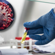 montage final 1765965524 Influenza A : Le Virus Qui Frappe Fort Pendant Les F&ecirc;tes!