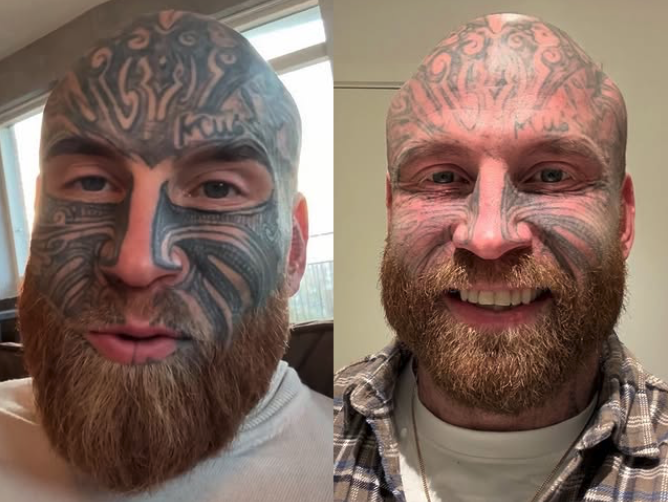 Capture le 2026 01 24 a 03.58.33 e1769245260873 Il change de visage: la transformation fait exploser les r&eacute;actions