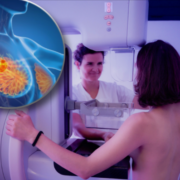 montage final 1768989154 Mammographie : Voici les risques dont on parle de plus en plus