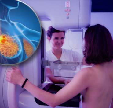 montage final 1768989154 Mammographie : Voici les risques dont on parle de plus en plus