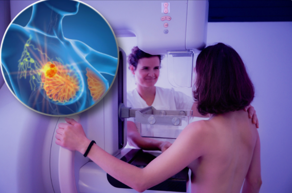 montage final 1768989154 Mammographie : Voici les risques dont on parle de plus en plus