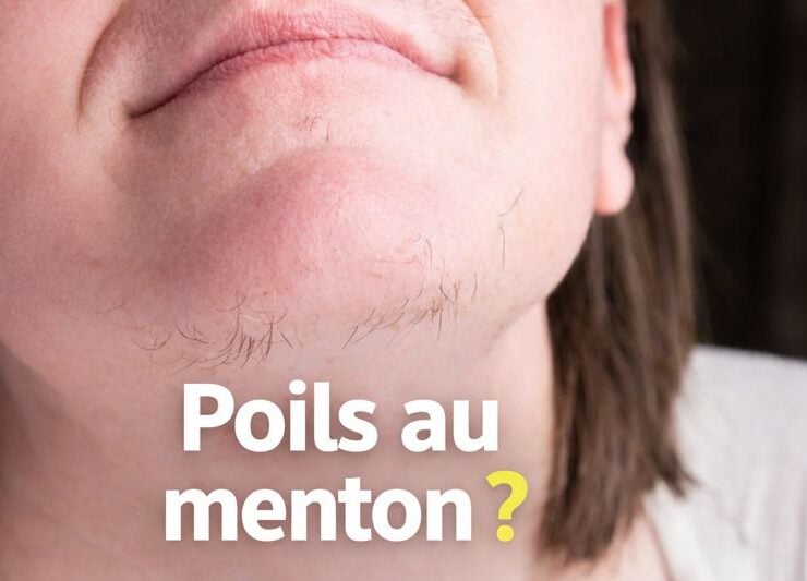 poilsm Vous avez des poils au menton ? Voici ce que &ccedil;a signifie