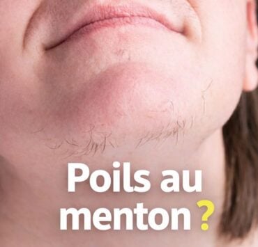 poilsm e1769536800990 Vous avez des poils au menton ? Voici ce que &ccedil;a signifie