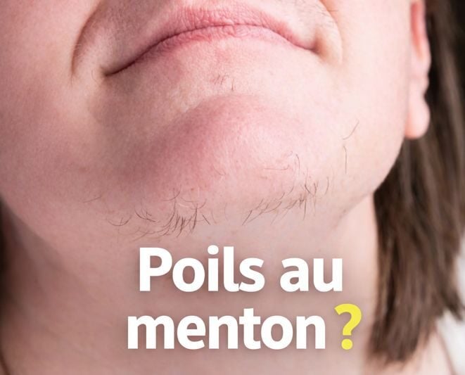 poilsm e1769536800990 Vous avez des poils au menton ? Voici ce que &ccedil;a signifie