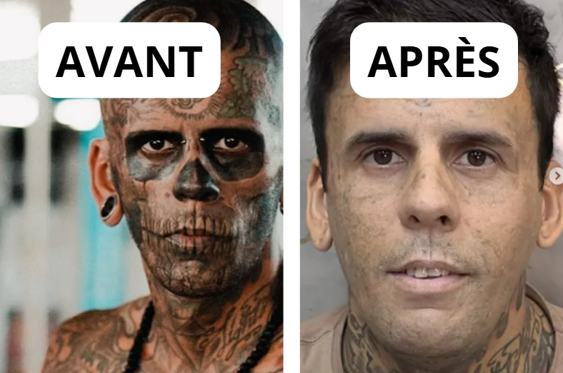 L’homme le plus tatoué fait enlever ses 177 tatouages et change totalement de visage 5 L’homme le plus tatoué fait enlever ses 177 tatouages et change totalement de visage Capture decran 2026 02 28 172537 L’homme le plus tatoué fait enlever ses 177 tatouages et change totalement de visage