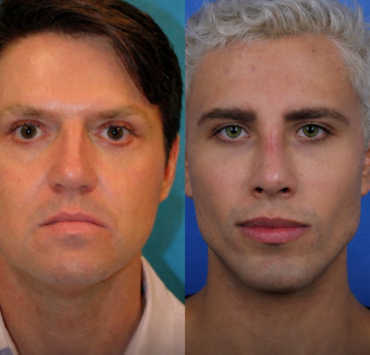 ChatGPT Image 10 fevr. 2026 a 18 33 26 Un homme a chang&eacute; d&rsquo;identit&eacute; et a subi 37 chirurgies esth&eacute;tiques pour tenter de revenir avec son ex, malgr&eacute; une ordonnance restrictive.