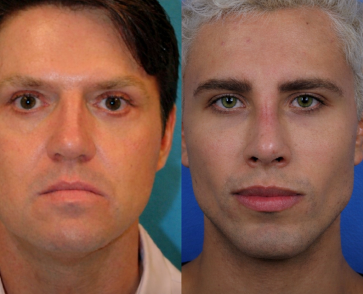 ChatGPT Image 10 fevr. 2026 a 18 33 26 Un homme a chang&eacute; d&rsquo;identit&eacute; et a subi 37 chirurgies esth&eacute;tiques pour tenter de revenir avec son ex, malgr&eacute; une ordonnance restrictive.