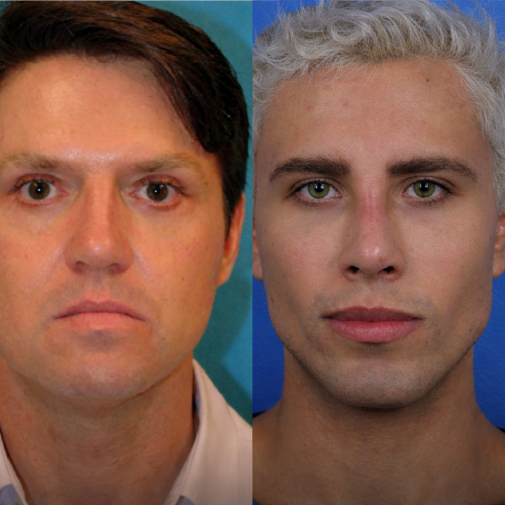 ChatGPT Image 10 fevr. 2026 a 18 33 26 Un homme a chang&eacute; d&rsquo;identit&eacute; et a subi 37 chirurgies esth&eacute;tiques pour tenter de revenir avec son ex, malgr&eacute; une ordonnance restrictive.