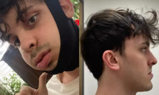 Capture decran 2026 03 17 121528 L&eacute;o Giroux transform&eacute; apr&egrave;s une chirurgie majeure&hellip; sa nouvelle apparence fait r&eacute;agir