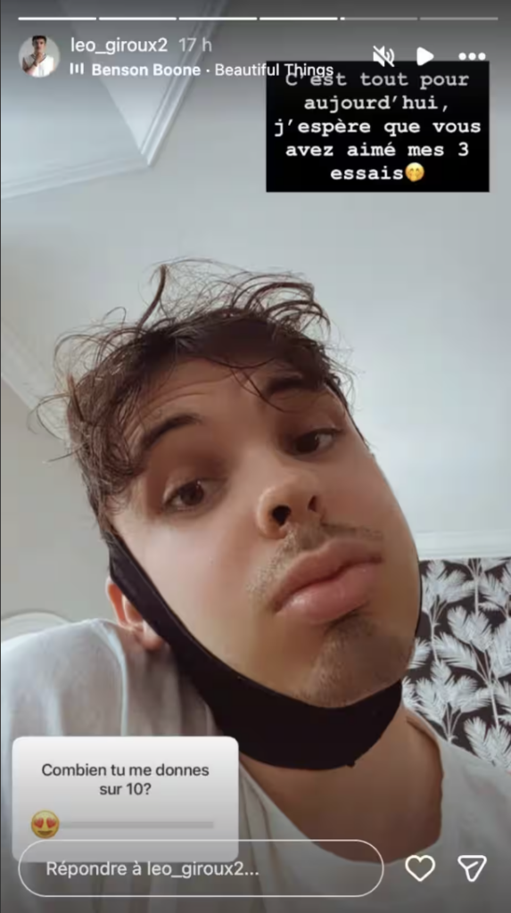 Capture le 2026 03 19 a 10.06.07 M&eacute;connaissable apr&egrave;s son op&eacute;ration du visage : L&eacute;o Giroux donne des nouvelles