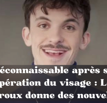 Capture le 2026 03 19 a 10.22.16 M&eacute;connaissable apr&egrave;s son op&eacute;ration du visage : L&eacute;o Giroux donne des nouvelles