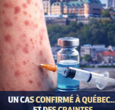 Capture decran 2026 04 09 153735 Rougeole &agrave; Qu&eacute;bec : un premier cas confirm&eacute;&hellip; et une inqui&eacute;tude qui monte rapidement
