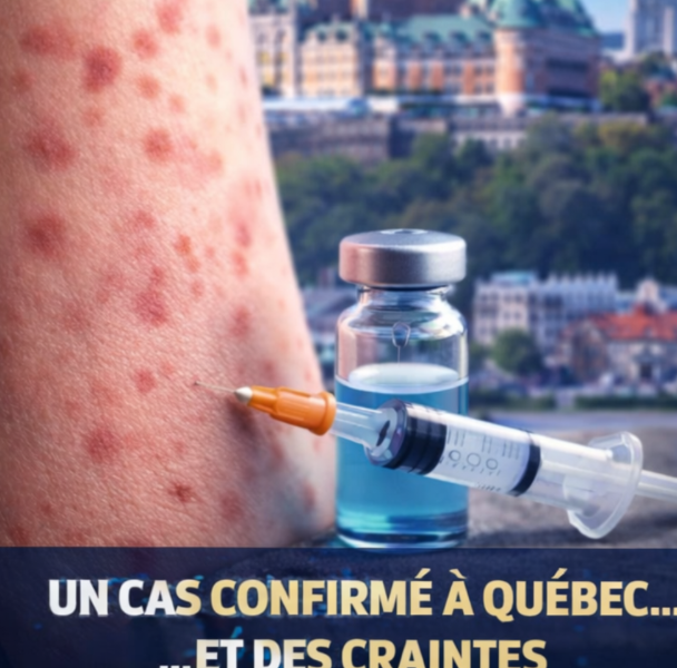 Capture decran 2026 04 09 153735 Rougeole &agrave; Qu&eacute;bec : un premier cas confirm&eacute;&hellip; et une inqui&eacute;tude qui monte rapidement