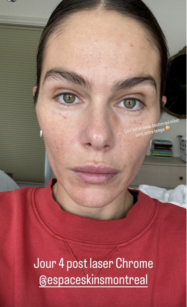 Capture le 2026 04 19 a 09.22.35 Maripier Morin s'ouvre sur ses rituels beaut&eacute; : les images de sa r&eacute;cente transformation faciale font jaser