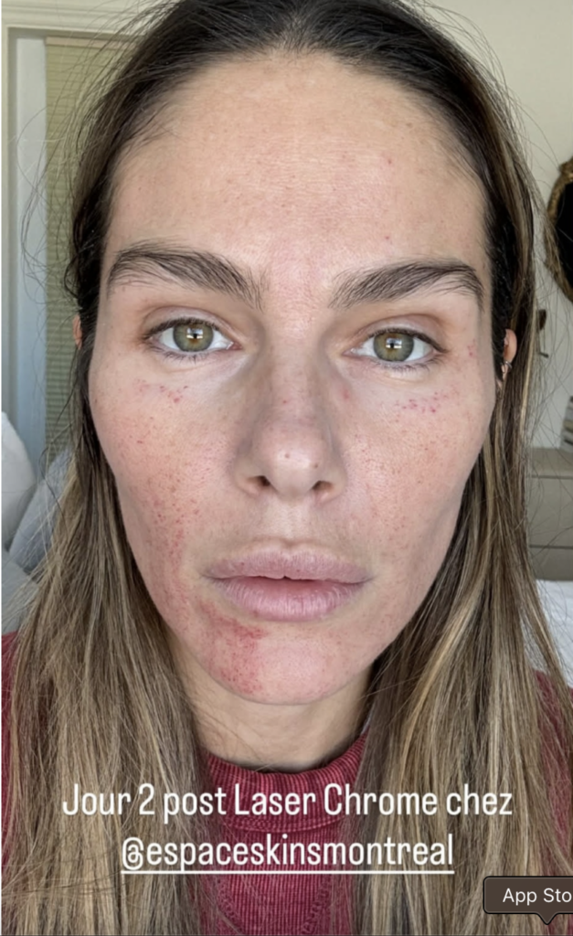 Capture le 2026 04 19 a 09.23.01 Maripier Morin s'ouvre sur ses rituels beaut&eacute; : les images de sa r&eacute;cente transformation faciale font jaser