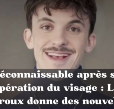 Capture le 2026 05 01 a 09.29.32 M&eacute;connaissable apr&egrave;s son op&eacute;ration du visage : L&eacute;o Giroux donne des nouvelles