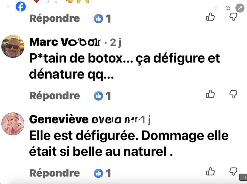 Guylaine Tremblay « défigurée »? Elle met les choses au clair 3 Guylaine Tremblay « défigurée »? Elle met les choses au clair Capture le 2026 06 09 a 10.24.43 Guylaine Tremblay « défigurée »? Elle met les choses au clair
