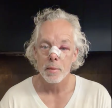 Capture decran le 2026 08 06 a 09.37.00 Fran&ccedil;ois Lambert surprend ses abonn&eacute;s avec une vid&eacute;o sur son &eacute;tat actuel