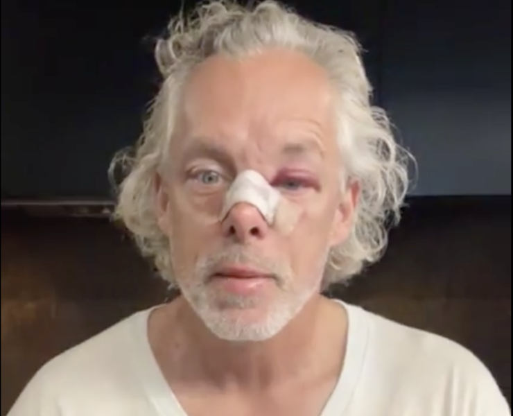 Capture decran le 2026 08 06 a 09.37.00 Fran&ccedil;ois Lambert surprend ses abonn&eacute;s avec une vid&eacute;o sur son &eacute;tat actuel
