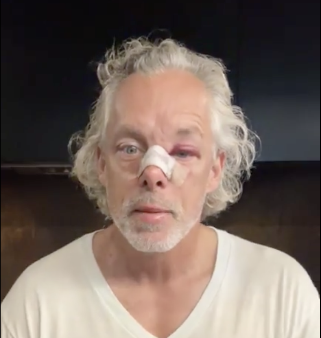 François Lambert surprend ses abonnés avec une vidéo sur son état actuel 1 François Lambert surprend ses abonnés avec une vidéo sur son état actuel Capture decran le 2026 08 06 a 09.37.00 François Lambert surprend ses abonnés avec une vidéo sur son état actuel