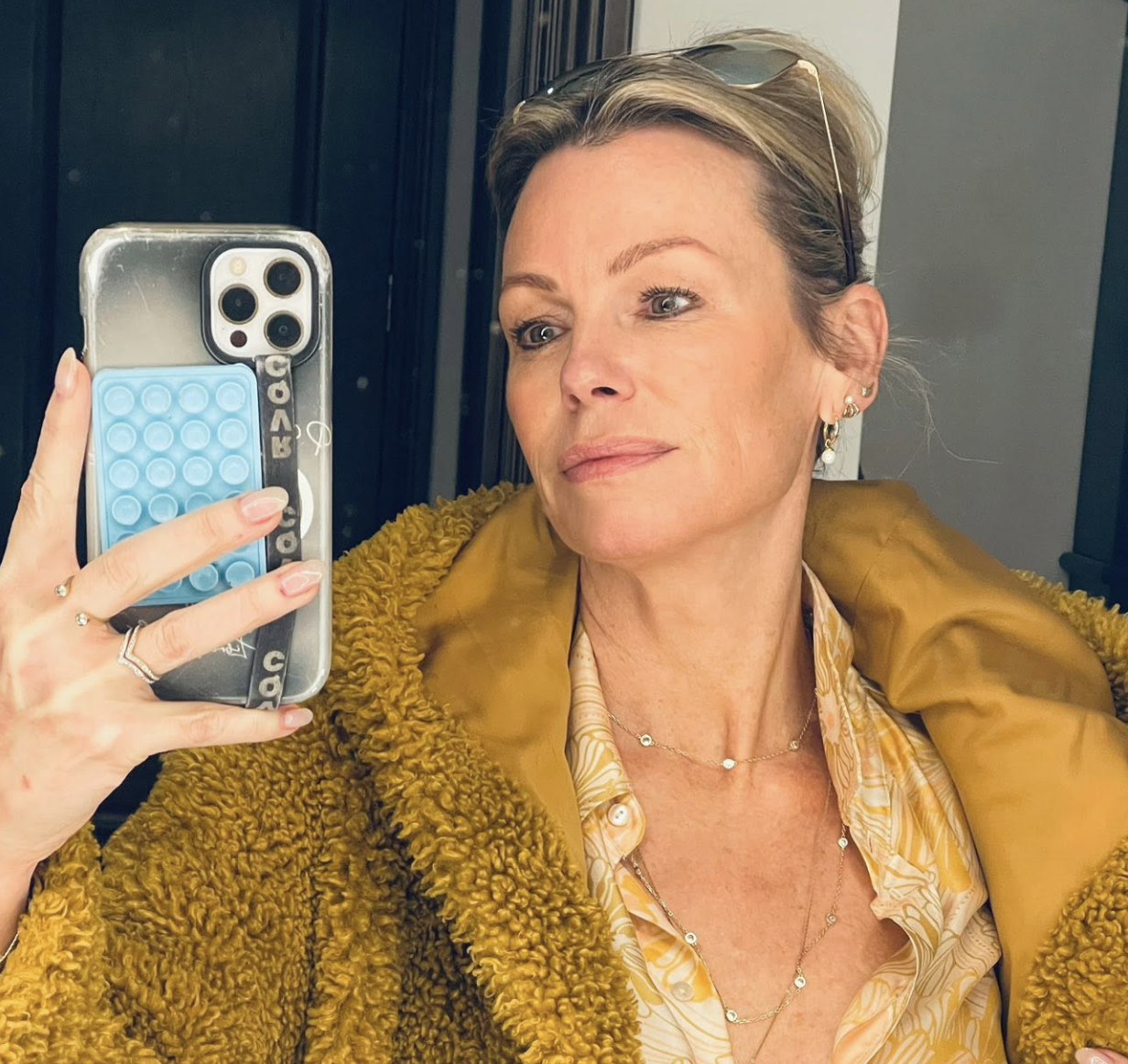 Caroline Néron révèle pourquoi elle reçoit des injections de Botox 1 Caroline Néron révèle pourquoi elle reçoit des injections de Botox Capture decran le 2026 08 12 a 14.15.17 Caroline Néron révèle pourquoi elle reçoit des injections de Botox