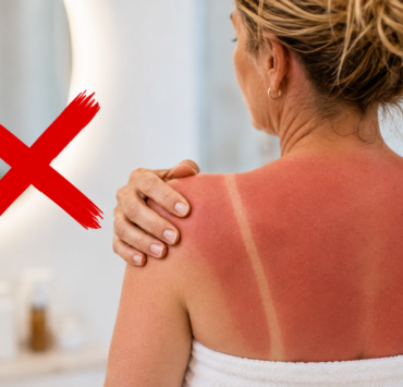 L'erreur la plus fréquente après un coup de soleil, selon des experts 3 L'erreur la plus fréquente après un coup de soleil, selon des experts ChatGPT Image 1 aout 2026 19 58 55 L'erreur la plus fréquente après un coup de soleil, selon des experts