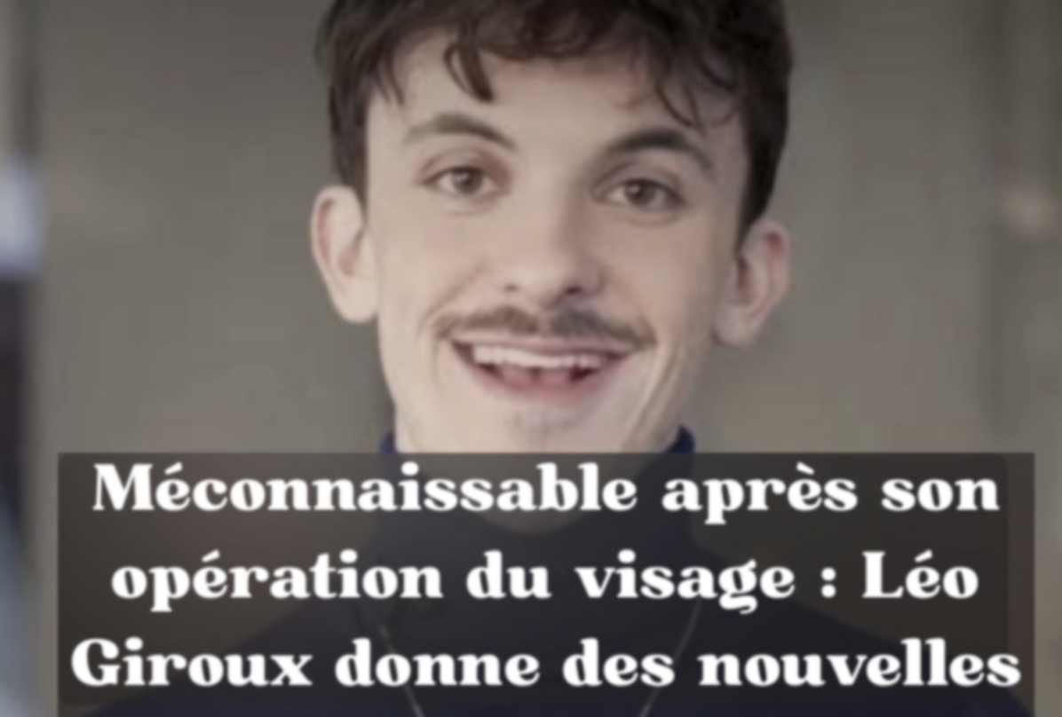 Méconnaissable après son opération du visage : Léo Giroux donne des nouvelles 1 Méconnaissable après son opération du visage : Léo Giroux donne des nouvelles Capture le 2026 09 21 a 08.41.32 Méconnaissable après son opération du visage : Léo Giroux donne des nouvelles
